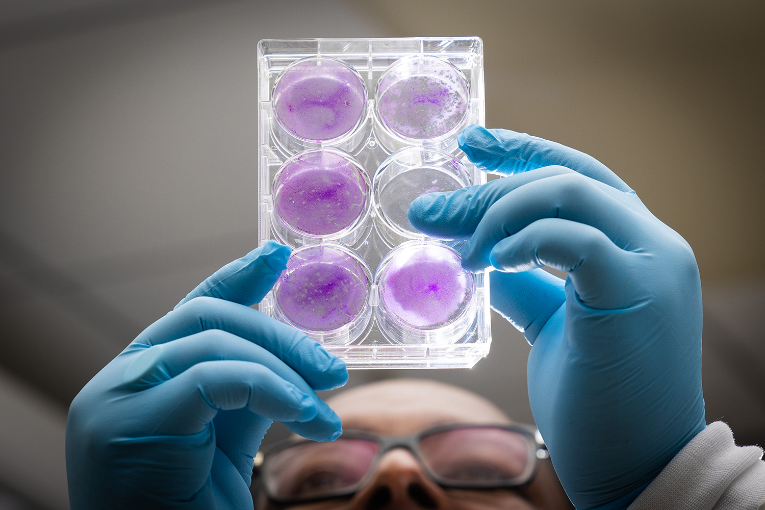 Craig Cameron looks into a tray of cell cultures
