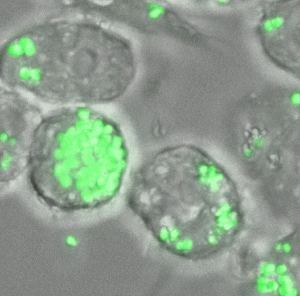 A cluster of round gray blobs signify human cells. Many tiny tennis ball colored dots cover the gray blobs, signifying an infection from bacteria.