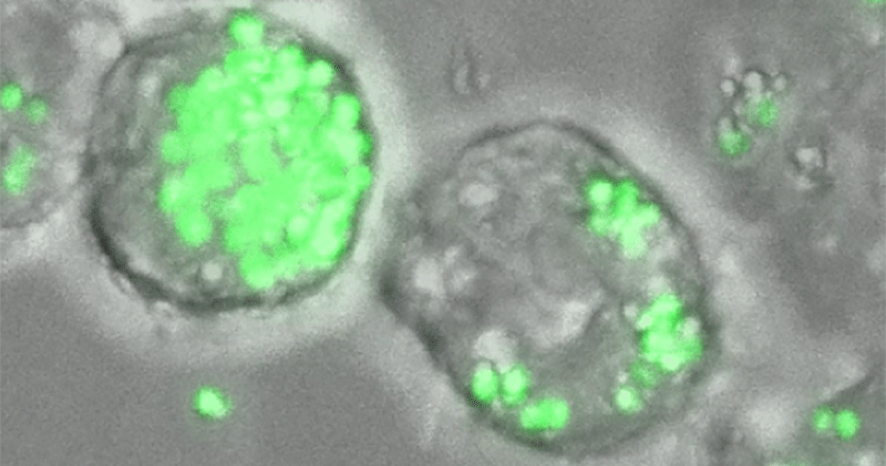 A cluster of round gray blobs signify human cells. Many tiny tennis ball colored dots cover the gray blobs, signifying an infection from bacteria.