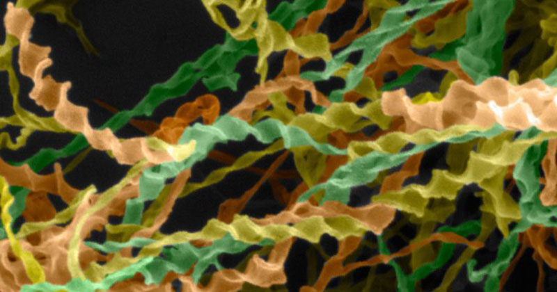 An electron microscopy image (falsely colored) of a beta-amyloid-derived peptide exhibiting helical twists.