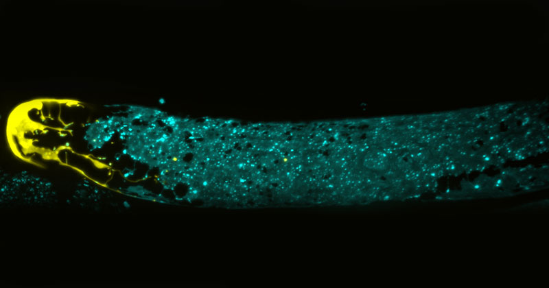 Adult C. elegans gonad expressing fluorescent proteins in the distal tip cell and somatic gonad sheath cells.